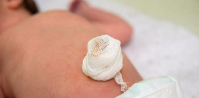Jangan Panik! Kenali Penyebab Pusar Bayi Berdarah dan Tips Mengatasinya