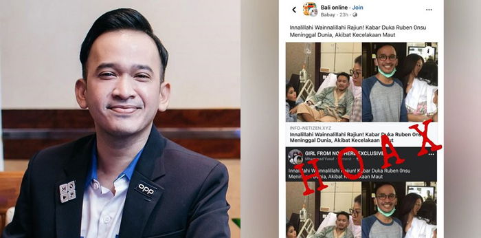 5 Fakta Kabar Ruben Onsu Meninggal, Dipastikan Hoaks!