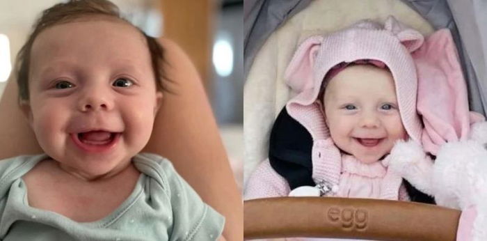 Punya Penyakit Langka, Bayi Ini Kesulitan Bergerak Seperti Menjadi 'Batu'