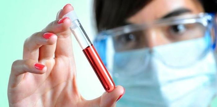 12 Jenis Kelainan Darah yang Paling Sering Ditemui, Cek Gejalanya!