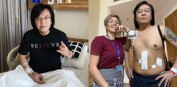 Kondisi Terkini Ari Lasso Usai Jalani Operasi, Belum Boleh Pulang dari Rumah Sakit