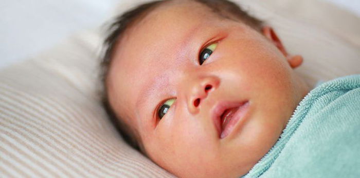 7 Penyebab dan Cara Mengatasi Mata Bayi Kuning yang Perlu Diwaspadai Parents!
