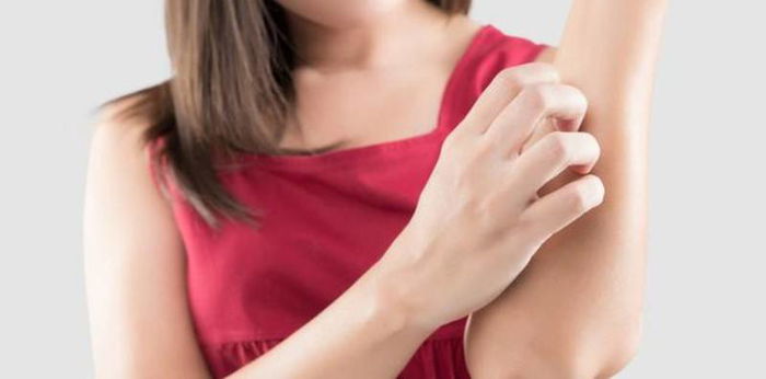 Sangat Menular! Ini 4 Kurap Jenis Kurap yang Bisa Dialami Siapa Saja