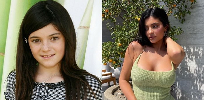 Sudah Banyak Berubah? Ini 7 Potret Transformasi Kylie Jenner dari Kecil hingga Kini