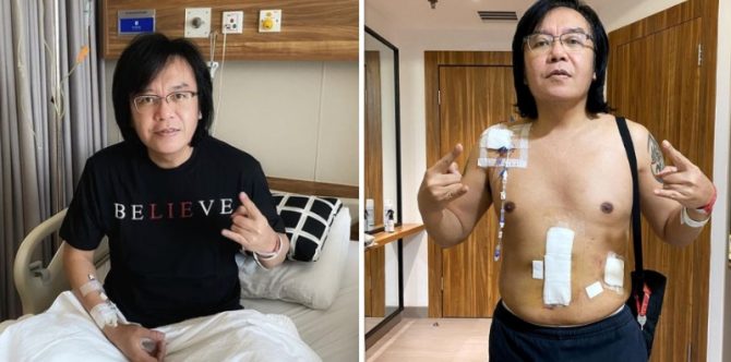 Terkena Kanker Limfoma Ganas dan Langka, Ari Lasso: "Optimis Sembuh"