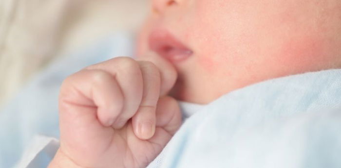 Waspadai Gejala Alergi Dingin pada Bayi dan Cara Tepat Mengatasinya