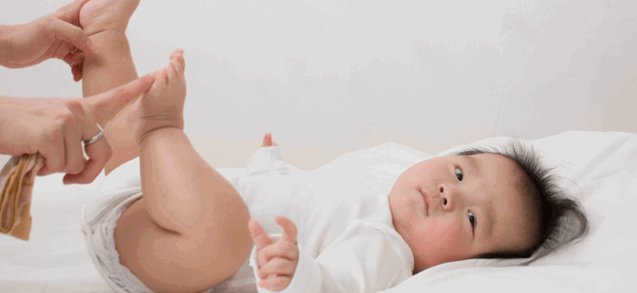 Ruam Popok, Ini Cara Mencegah dan Pengobatan Rumahan yang Bisa Dilakukan