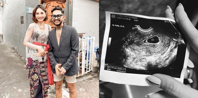 Istri Onadio Leonardo Keguguran, "Rest in Peace My Little Sunshine"