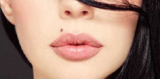 7 Cara Menghilangkan Tahi Lalat, Mulai dari Cara Alami hingga Prosedur Medis