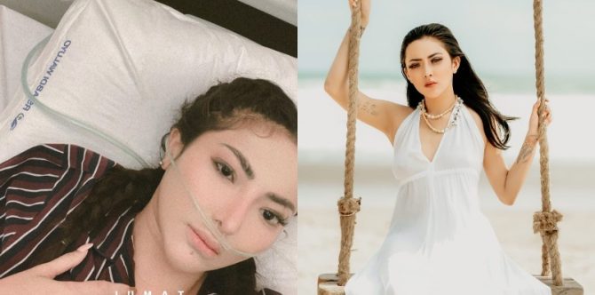 Dinyatakan Mati Suri, Model Ayu Aulia Alami Henti Jantung Mendadak
