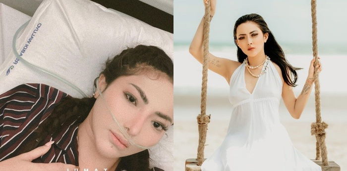 Dinyatakan Mati Suri, Model Ayu Aulia Alami Henti Jantung Mendadak