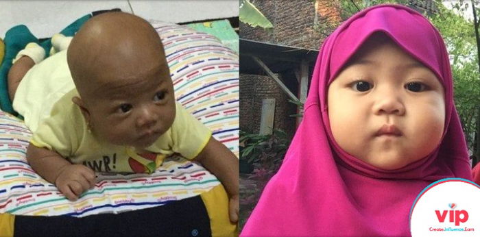 "Lahir dengan Sehat, Ternyata Putriku Mengalami Kelainan Hormon"