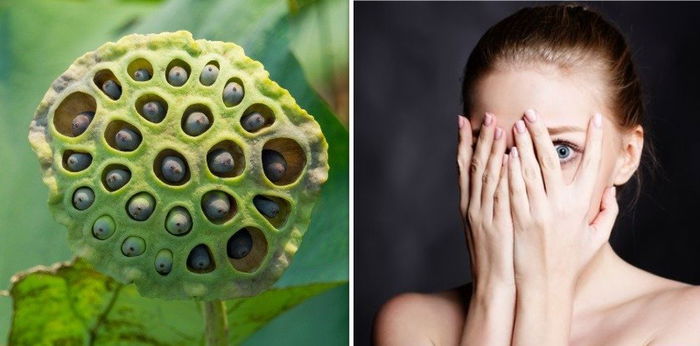 Fobia Melihat Lubang Kecil Atau Bintik, Kenali Gejala dan Penyebab Trypophobia
