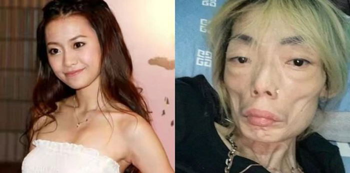 Cerita Tragis Model Cantik Wu Zhiheng yang Menjadi Lumpuh dan Dicampakkan Suami     