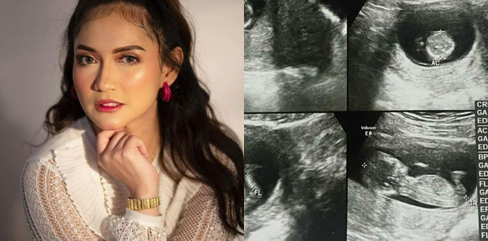 Sering Didoain Tambah Anak, Corry Pamela Umumkan Hamil Anak Ketiga