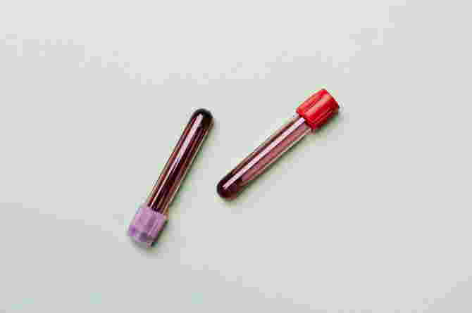 kekurangan magnesium