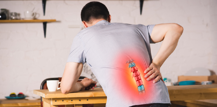 Mengenal Kondisi Skiatika atau Linu Panggul: Gejala, Penyebab, Pengobatan, hingga Pencegahan