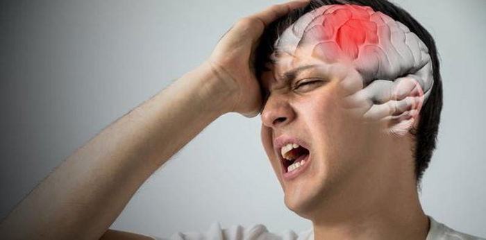 7 Jenis Penyakit Saraf dan Gejala yang Perlu Diwaspadai