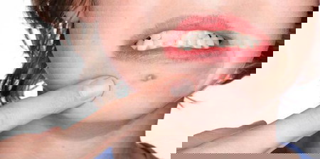 9 Manfaat Minyak Sawit, Hilangkan Jerawat hingga Mencegah Kanker!