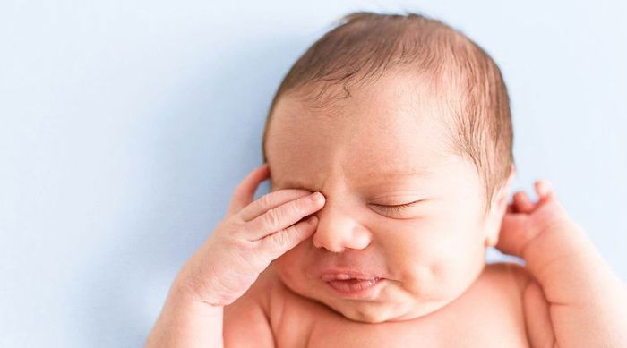 4 Pilihan Salep Mata untuk Bayi Belekan, Aman Digunakan Sejak Bayi Baru Lahir