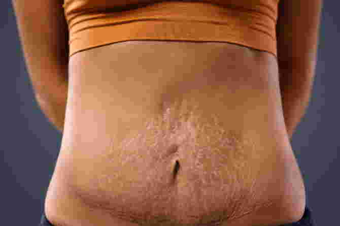 kondisi rahim setelah melahirkan