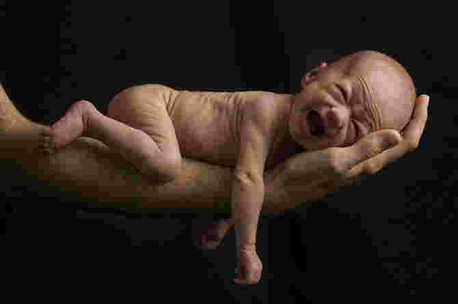 Skinny Baby Worries? Parents Must Know the Causes and How to Deal With It