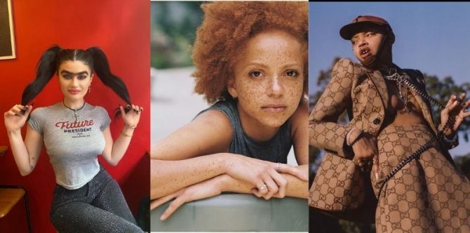 Tampil Apa Adanya, 8 Model Ini Dobrak Standar Kecantikan