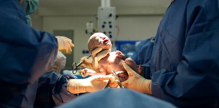 Catat, Bun! Ini Perkiraan Biaya Operasi Caesar di 20 Daerah di Indonesia