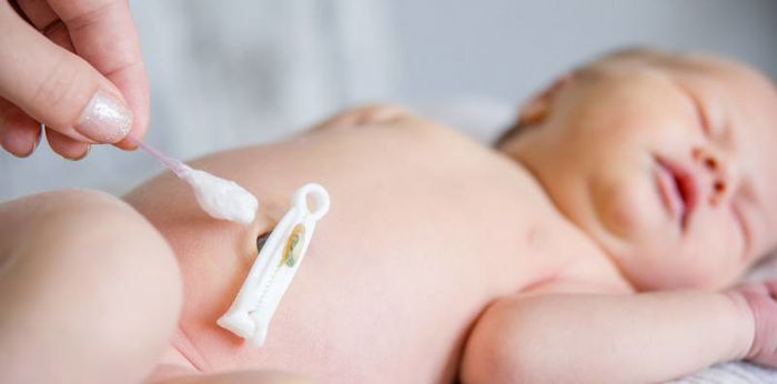 Tali Pusat Bayi, Pahami Cara Membersihkan dan Merawatnya