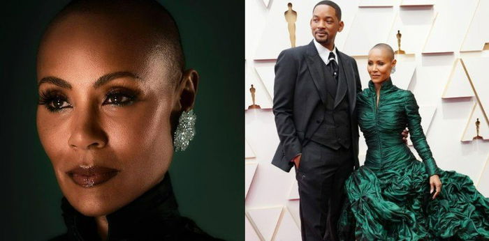 Jada Pinkett Smith dan Kisah Perjuangannya Melawan Penyakit Alopecia