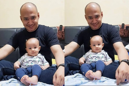 artis botak