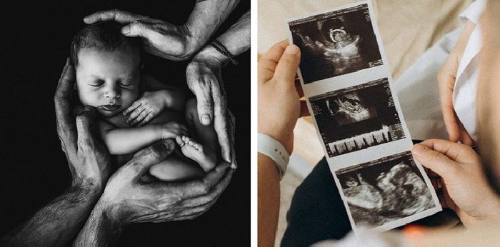 7 Ciri-Ciri Hamil Anak Laki-Laki yang Akurat 100 Persen, Fakta atau Mitos?