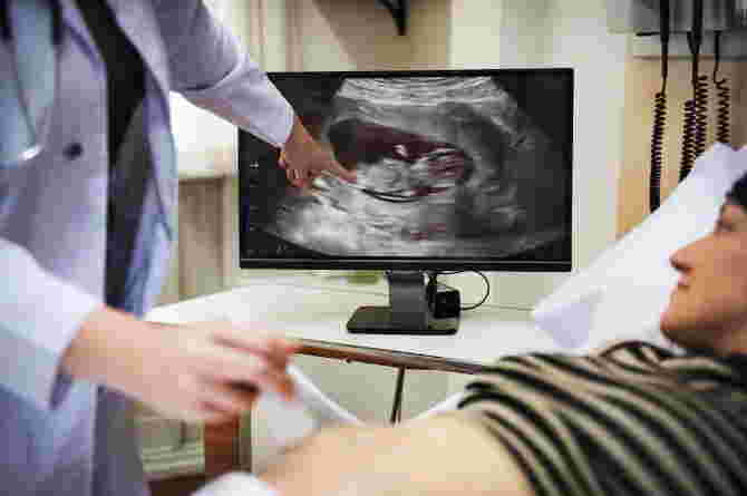 Why Can USG HPL Change? Turns Out These Are 6 Causes, Mom!