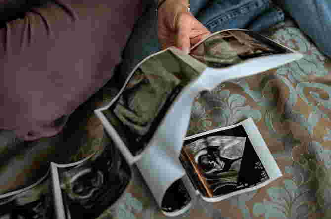 Know What Ovulation Is and When It Happens? Know to Make Promil Successful