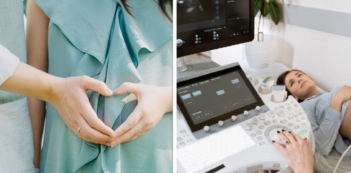 Bukan Semester, Ini Penjelasan Lengkap tentang Trimester Kehamilan