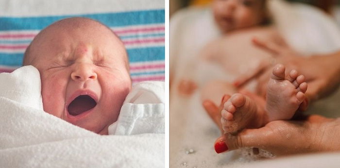 10 Obat Alami Cacar Air pada Balita yang Wajib Parents Tahu