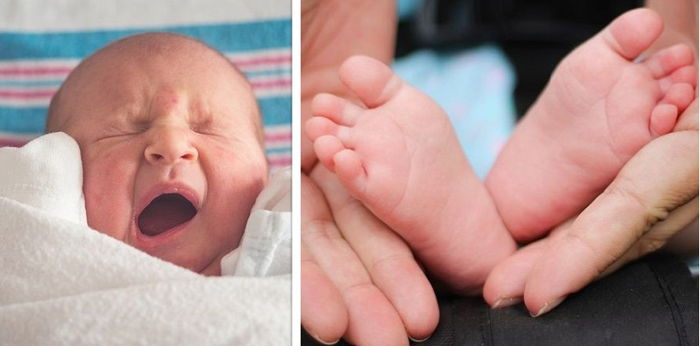 Waspada! Kenali Penyakit Hand Foot Mouth Disease (HFMD) pada Anak