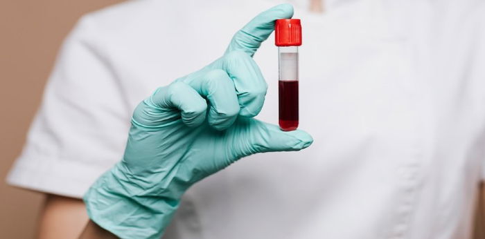 Jenazah Eril Dipastikan dari Tes DNA, Seperti Ini Cara Kerjanya