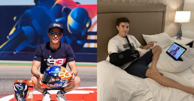 Kondisi Teranyar Marc Marquez Usai Jalani Operasi Keempat Kalinya