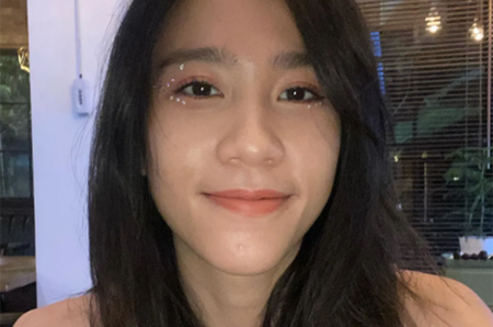 gigi eks cherrybelle alami anoreksia
