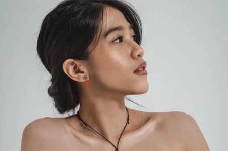 gigi eks cherrybelle alami anoreksia