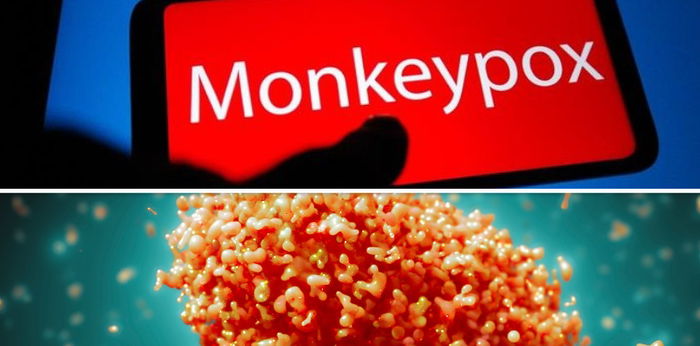 WHO Tetapkan Cacar Monyet Jadi Darurat Kesehatan Global