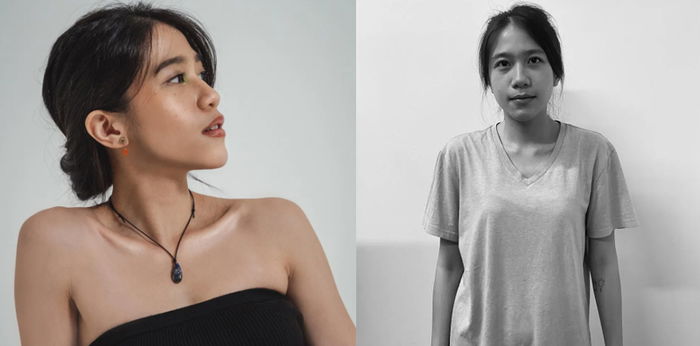 Alami Anoreksia, Gigi Eks Cherrybelle Berani Cari Pertolongan Profesional