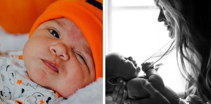 Gonore pada Bayi: Penyebab, Proses Penularan, Pencegahan