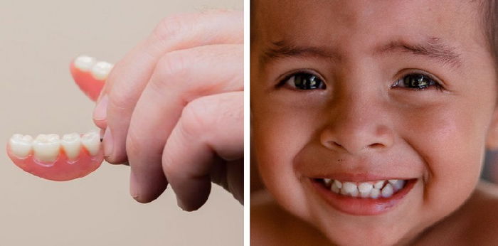 Pertumbuhan Gigi Bayi Tidak Rata, Kenali Faktor Penyebab dan Cara Mengatasinya