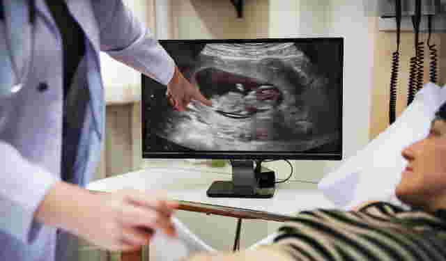 Pierre Robin Syndrome: Symptoms, Causes, and Treatment