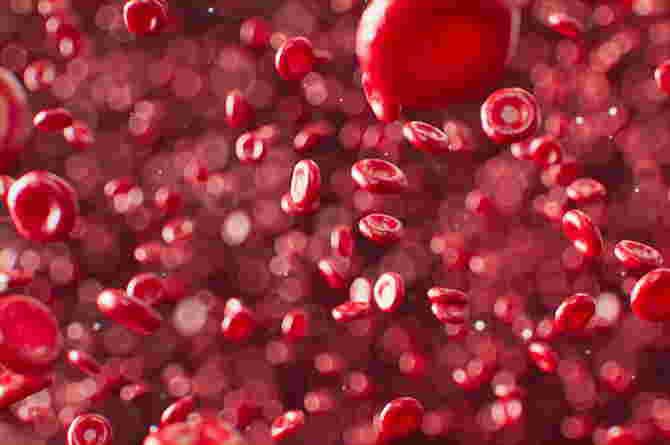 Kernicterus: Causes, Symptoms, Risk Factors, Treatment