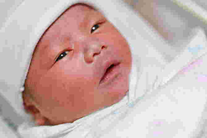 How to Determine Gestational Age of Newborn Baby with Ballard Score