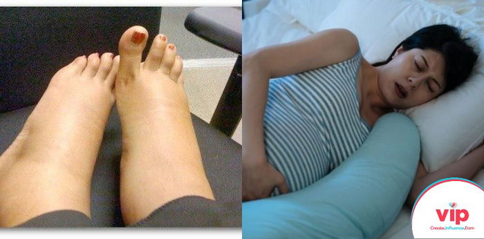 "Pengalaman Hamil dengan Preeklampsia hingga Hampir Merenggut Nyawa"