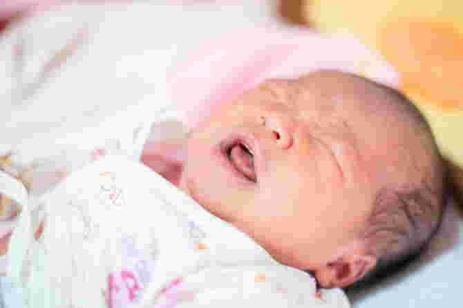 Recognize the Symptoms and Causes of Diaphragmatic Hernia in Babies